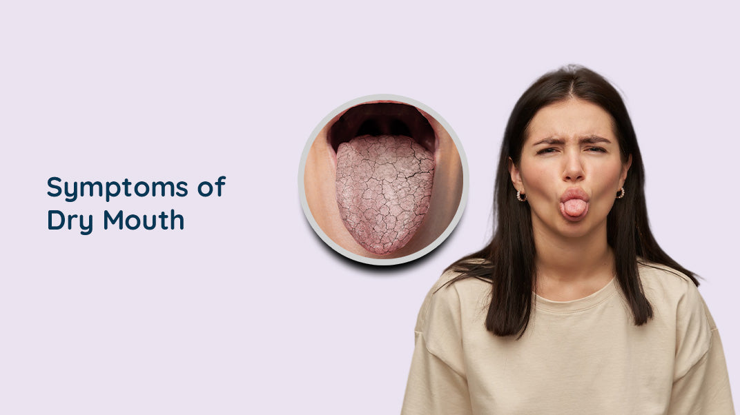 What are the Symptoms of Dry Mouth?