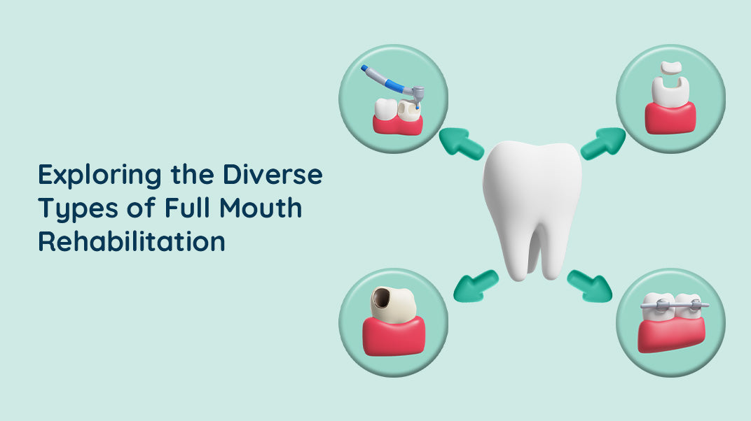 Types of Full Mouth Rehabilitation