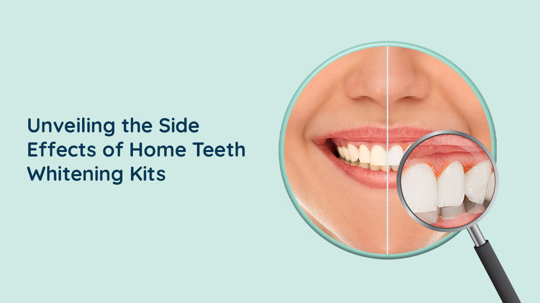 What are the Side effects of home teeth whitening kits?