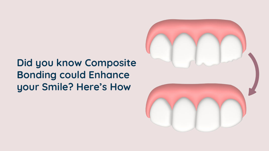 Compassing Bonding Enhance Your Smile with Composite Bonding – ORACURA