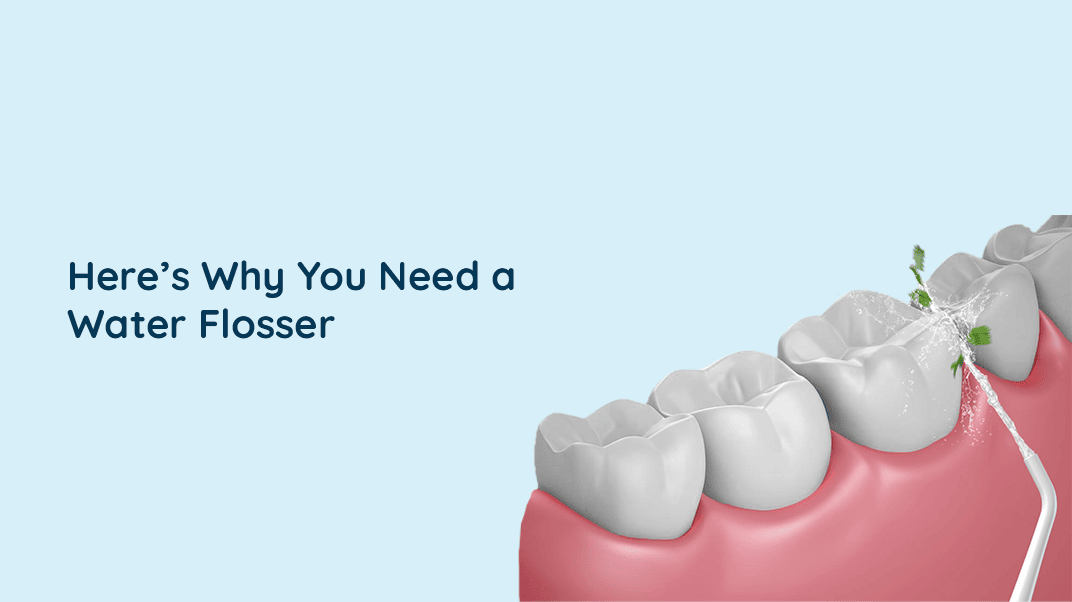 Why Should You Consider A Water Flosser?