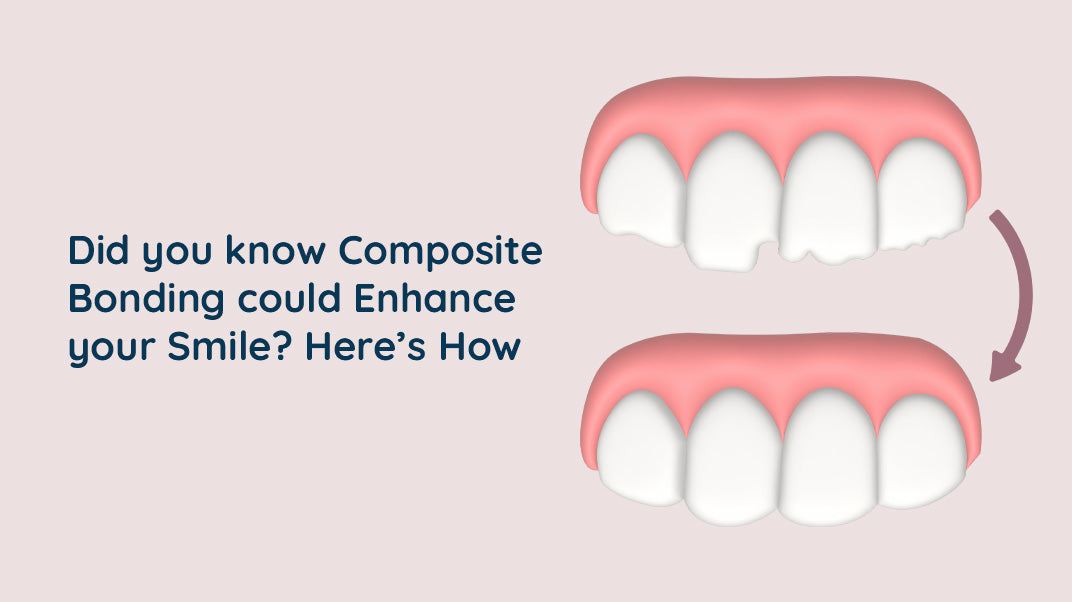 How Composite Bonding Can Enhance Your Smile ?