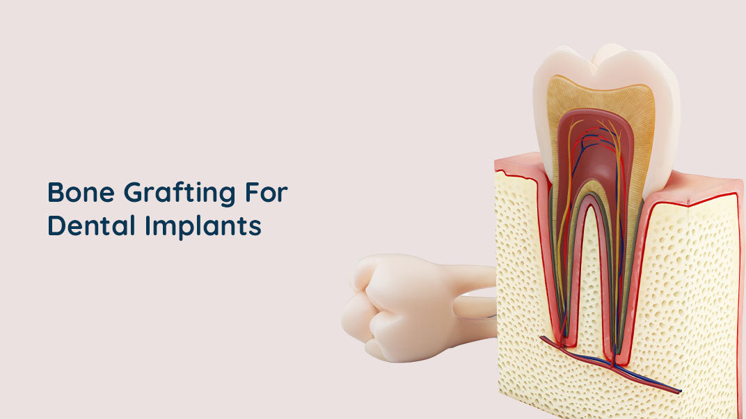 The Importance of Preserving Tooth Structure