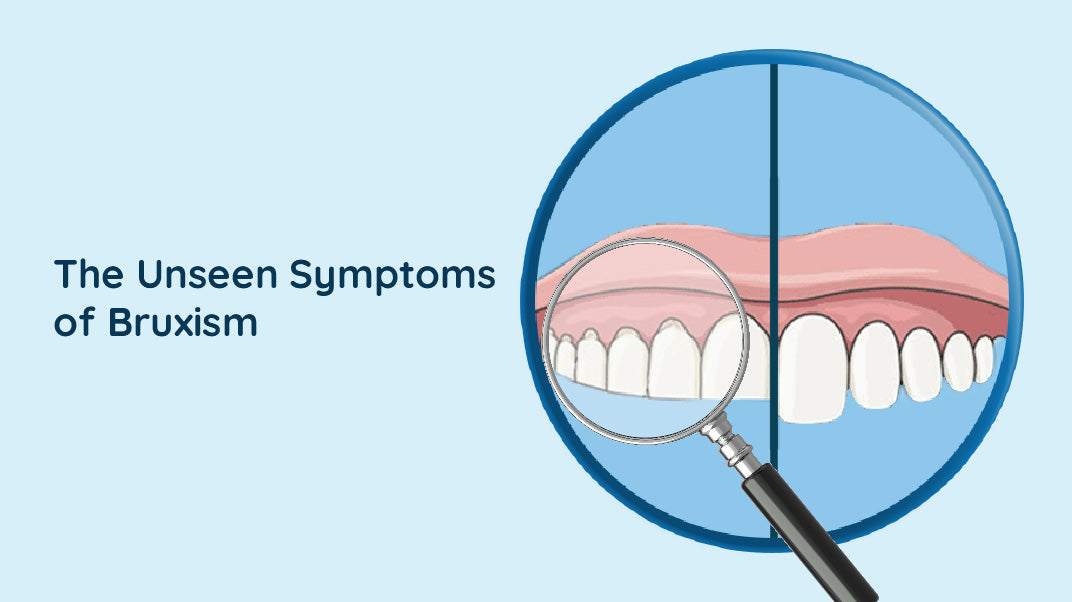 Bruxism: Signs And Symptoms