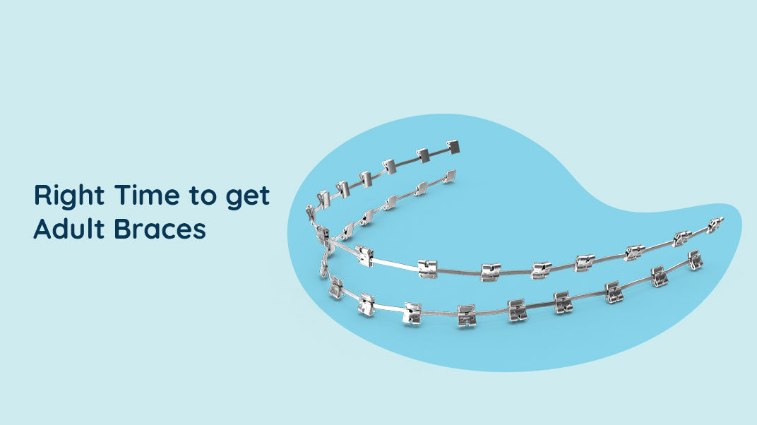 When is the Right Time to get Adult Braces?
