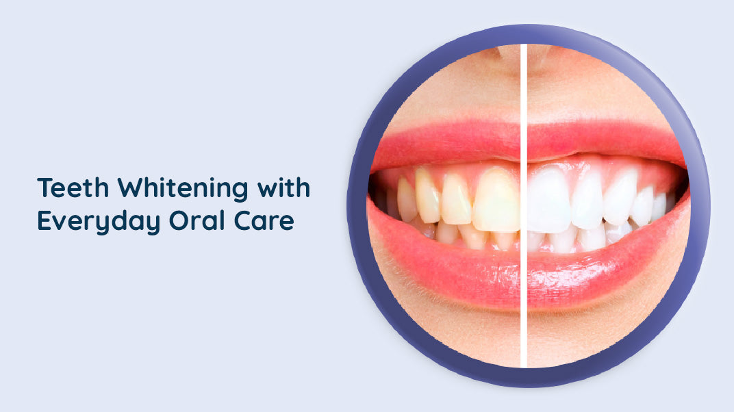 Teeth Whitening: How to Get White Teeth