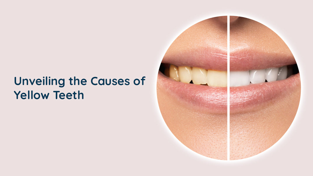 What Causes Yellow Teeth?