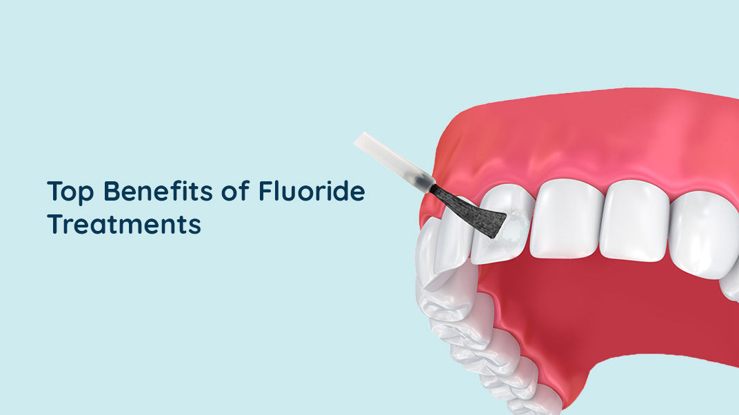Fluoride Treatments and Its Benefits