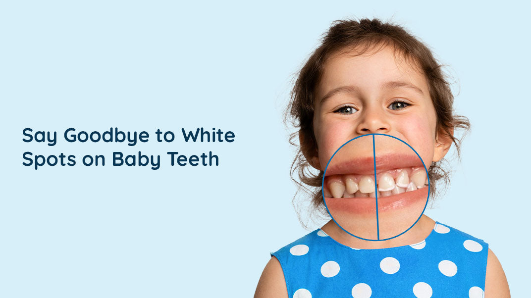 What Causes White Spots on Baby Teeth?