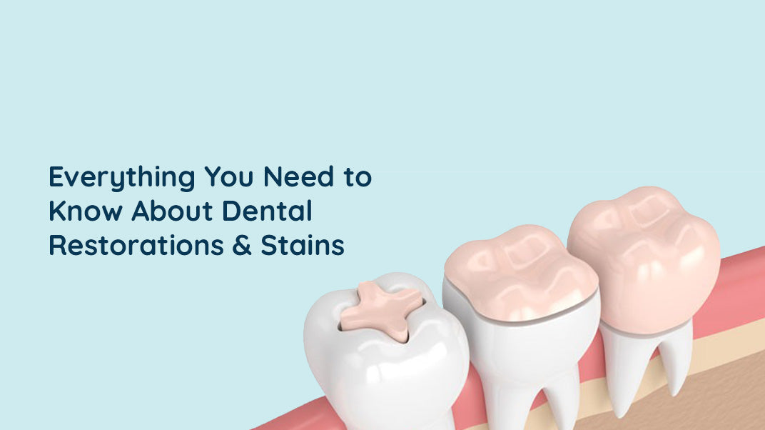 Do Dental Restorations Stain?