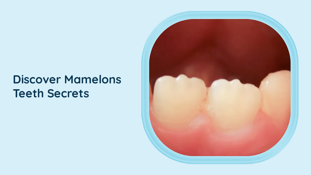 What Are Mamelons Teeth? - ORACURA