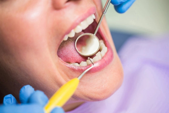 Long-Term Impacts of Neglecting Oral Hygiene