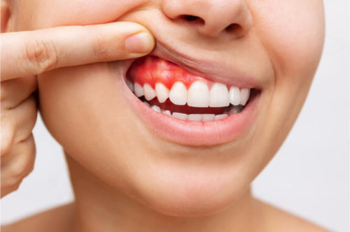 Understanding Gingival Inflammation: Research Insights
