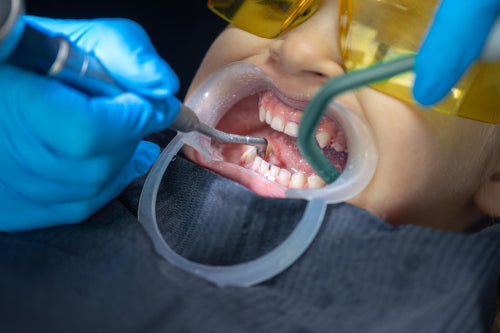 Orthodontic Care Extends Beyond Alignment to Include Thorough Cleaning Methods