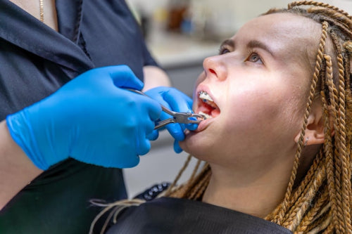 How Orthodontists Talk About Cleaning Around Wires and Brackets