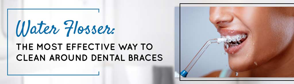 Water Flosser: The Most Effective Way to Clean Around Dental Braces