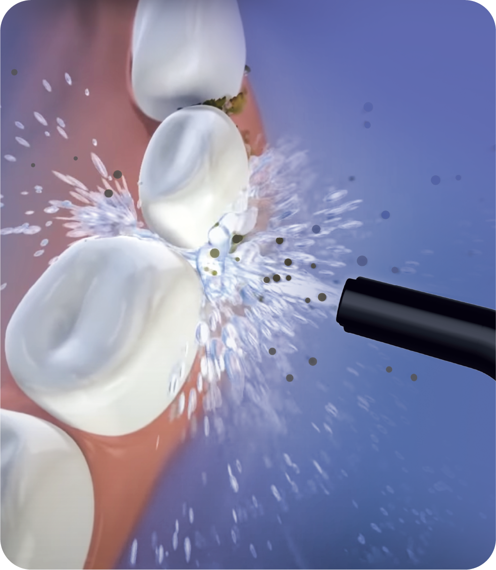 OC450 Countertop Smart Water Flosser®